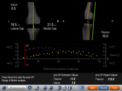 Dujardin Jan Dokter Orthopedie Knie Heup specialist prothese